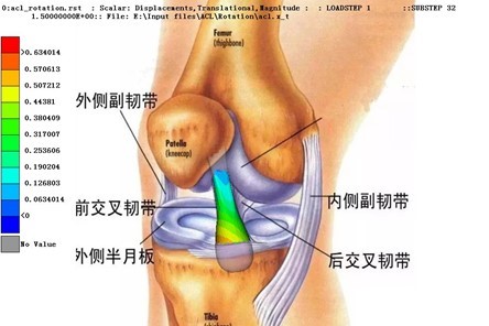 Biomedical stress analysis of anterior cruciate ligament