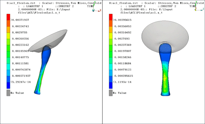 Simulation Analysis of Anterior Cruciate Ligament (Figure 5)