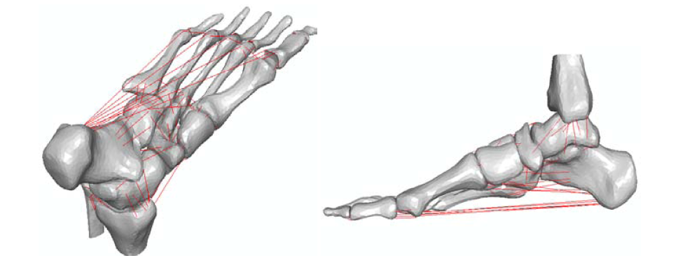 Simulation Analysis of the Force on the Anterior Cruciate Ligament in Medicine (Figure 10)