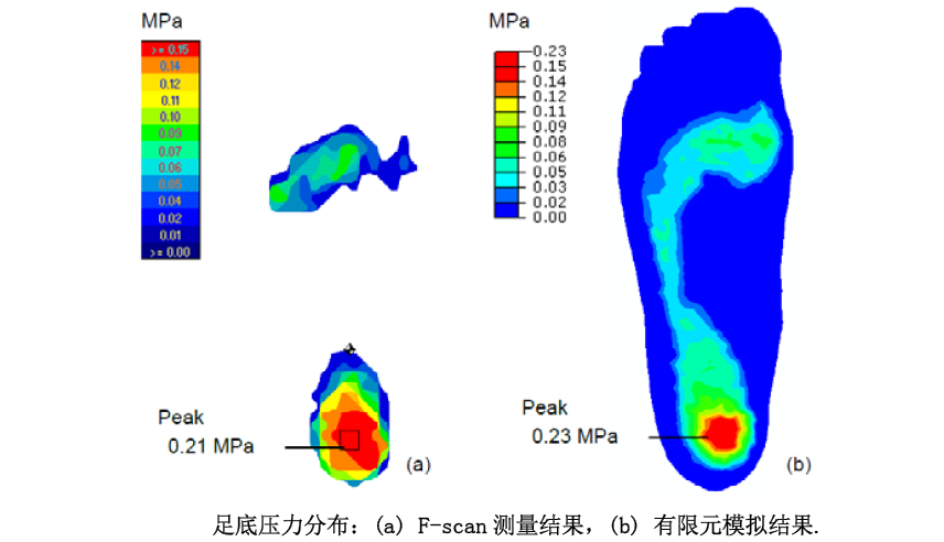 Simulation Analysis of the Force on the Anterior Cruciate Ligament in Medicine (Figure 12)