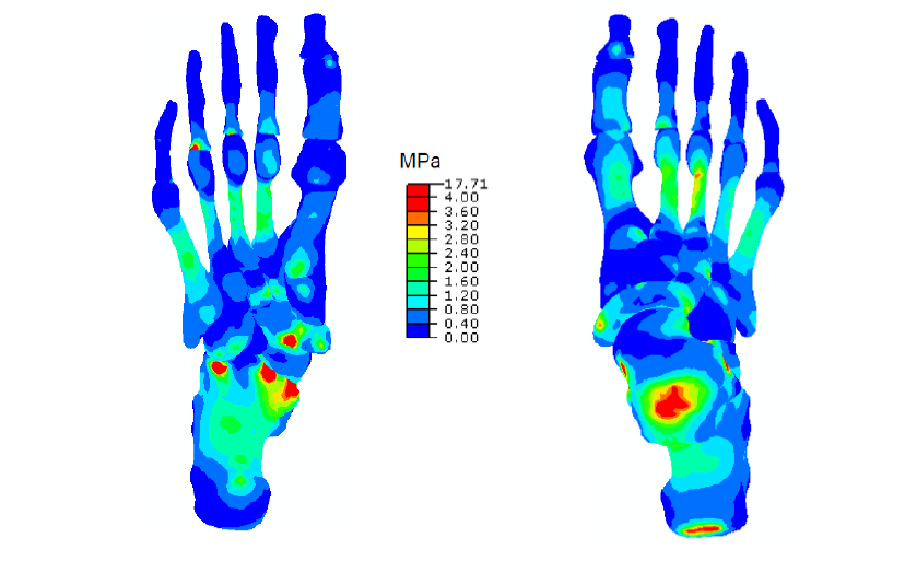 Simulation Analysis of the Force on the Anterior Cruciate Ligament in Medicine (Figure 13)