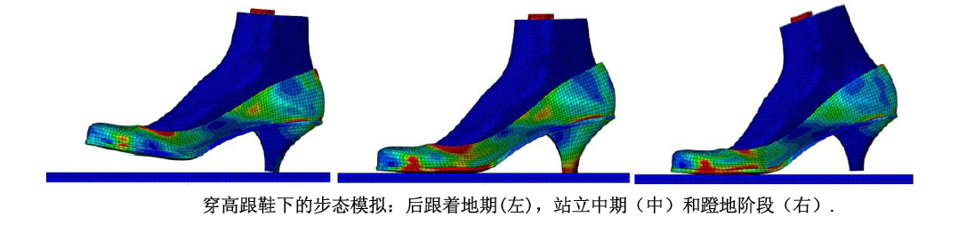 Simulation Analysis of the Force on the Anterior Cruciate Ligament in Medicine (Figure 14)