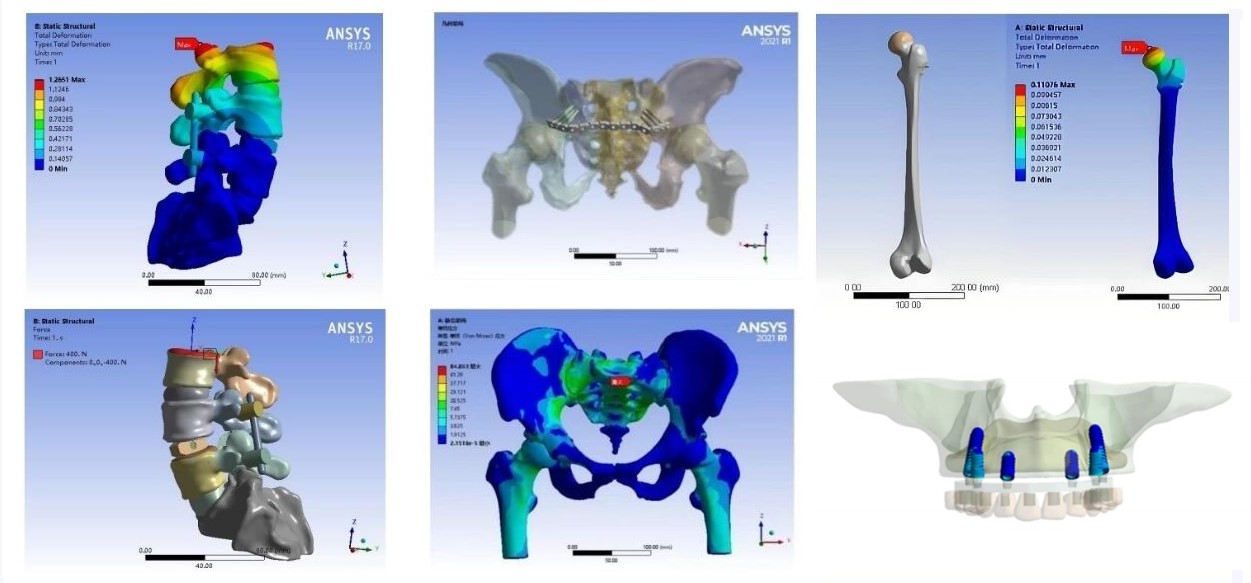 Finite Element Analysis for Biomedical Applications