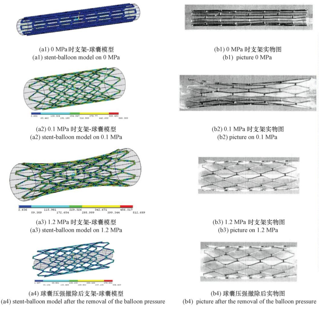 Finite Element Simulation of the Deformation of Medical Vascular Stents (Figure 4)