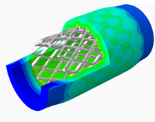 Deformation finite element simulation of medical vascular stent
