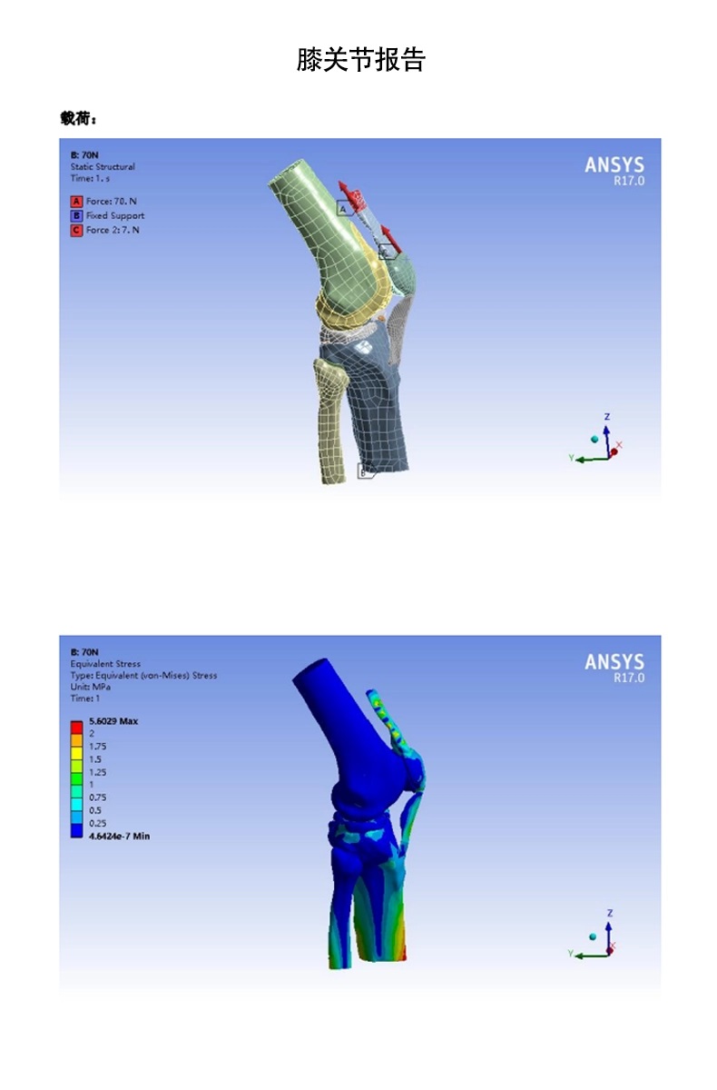 Biomedical Finite Element Analysis